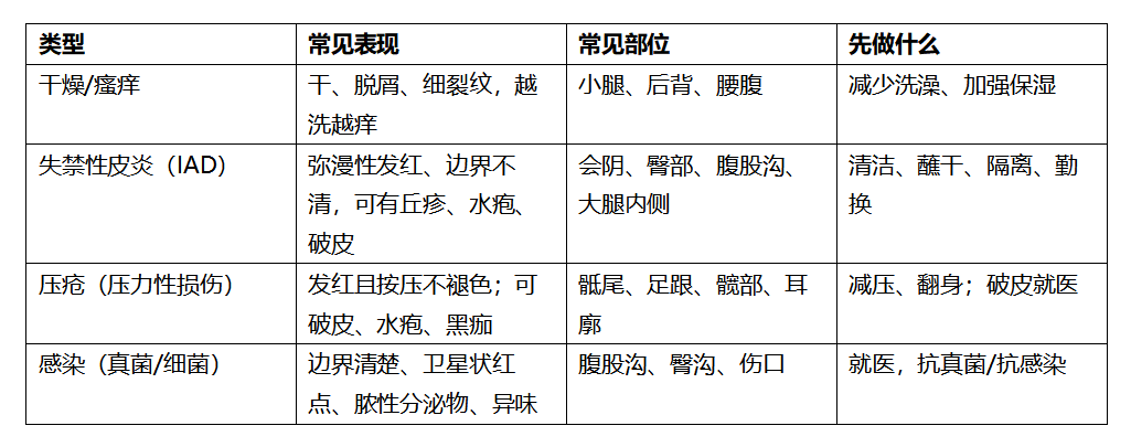 一、先分清:4 类问题,处理方式不一样